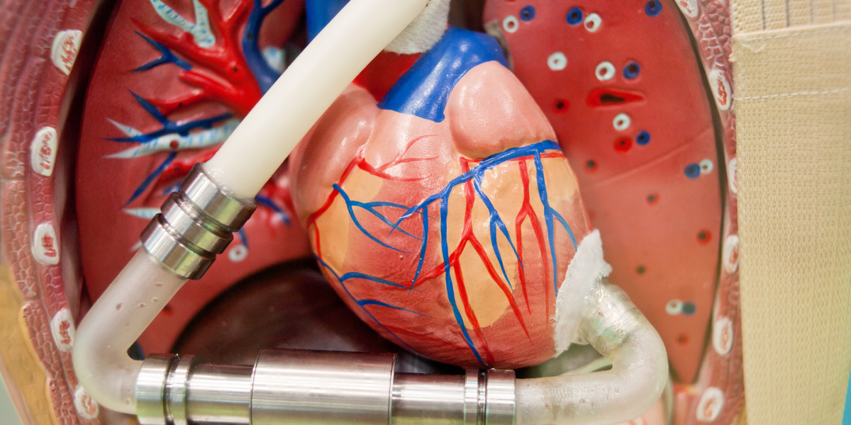 The Top Ten Things That Can Go Wrong Without The Remote Monitoring Of