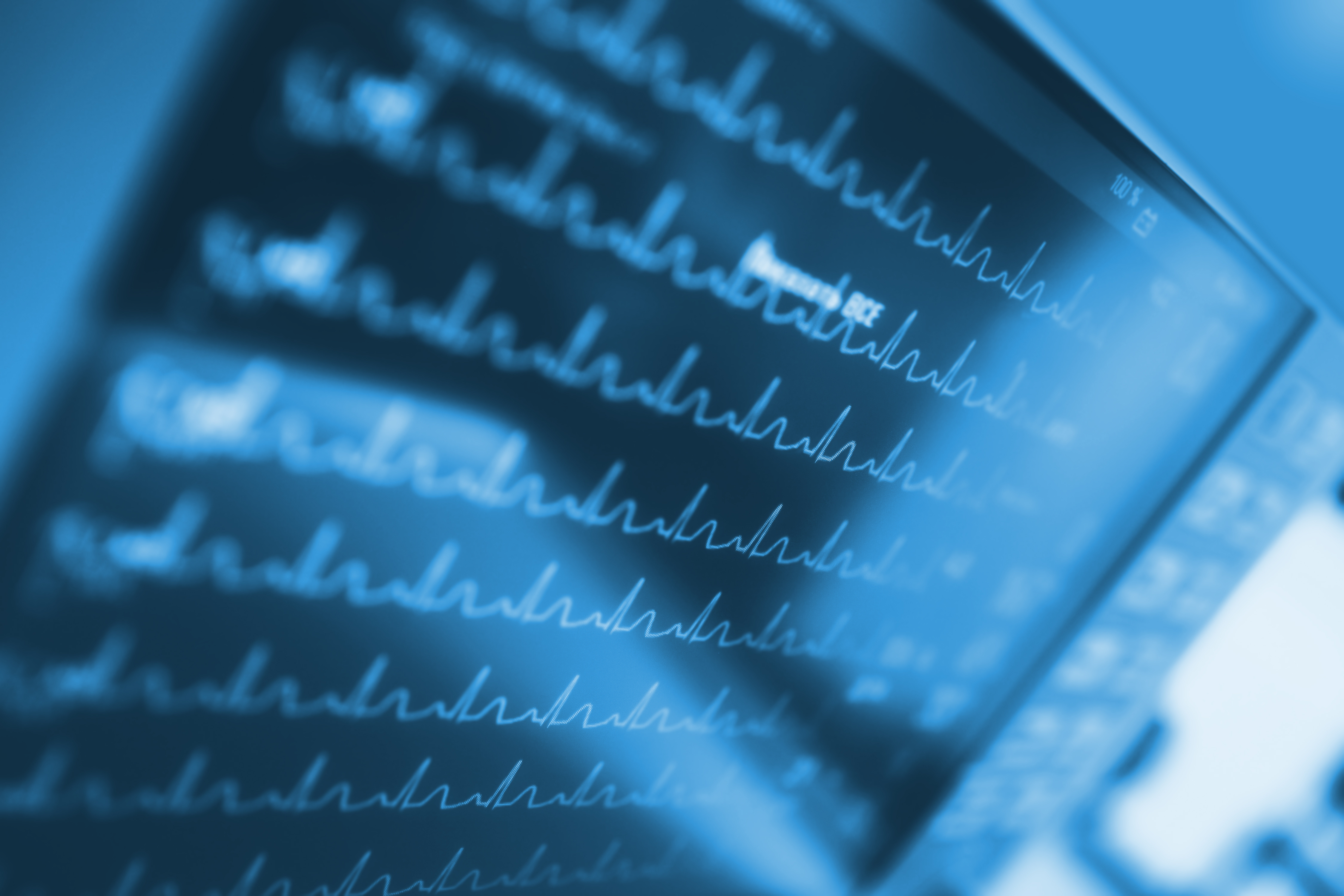 Are Energy Drinks Bad For Your Heart and Heart Rhythm? VA Heart Beat