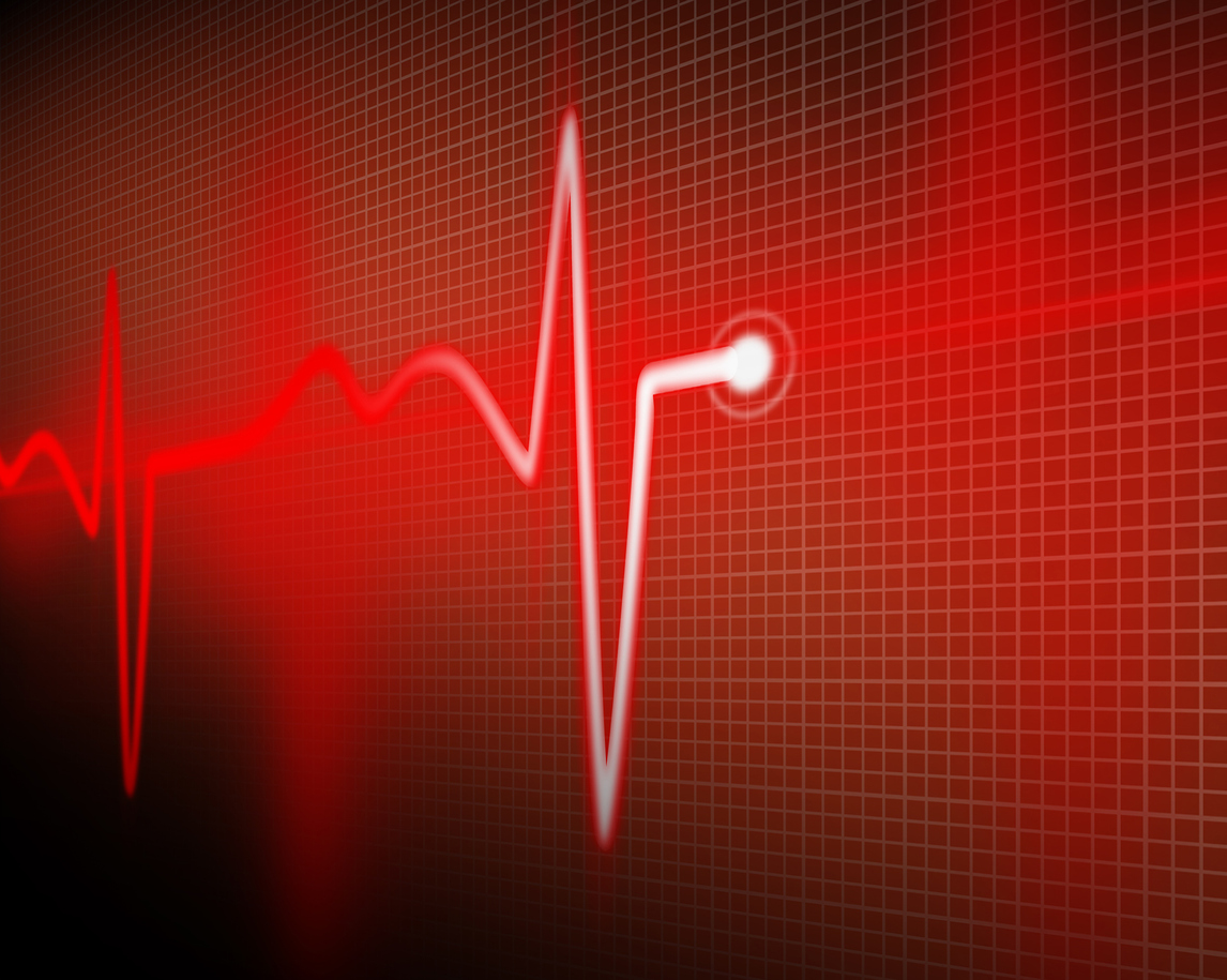 Conduction Disorders: The Heart Health Problem You Don’t See
