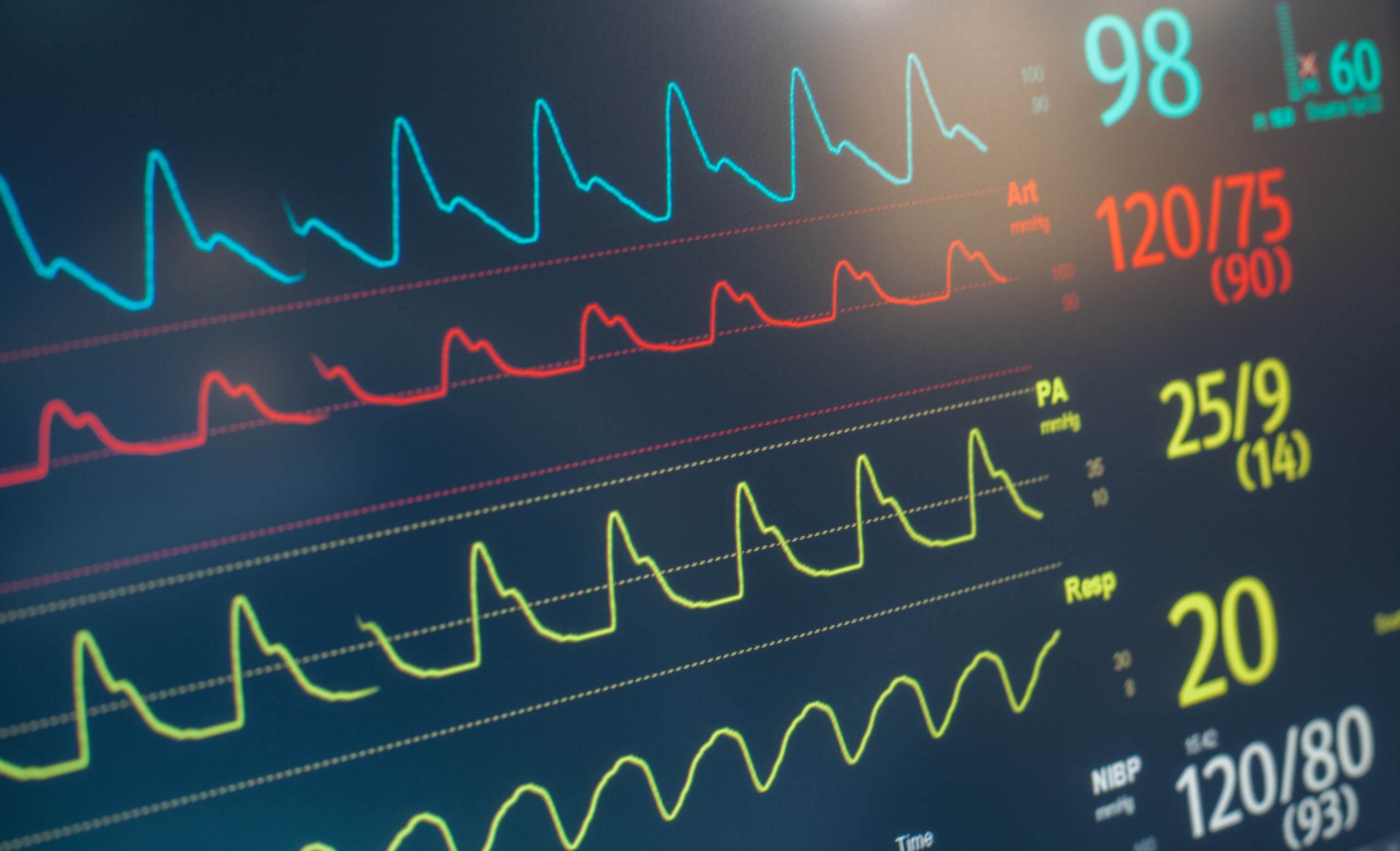 Remote Monitoring for Cardiac Devices